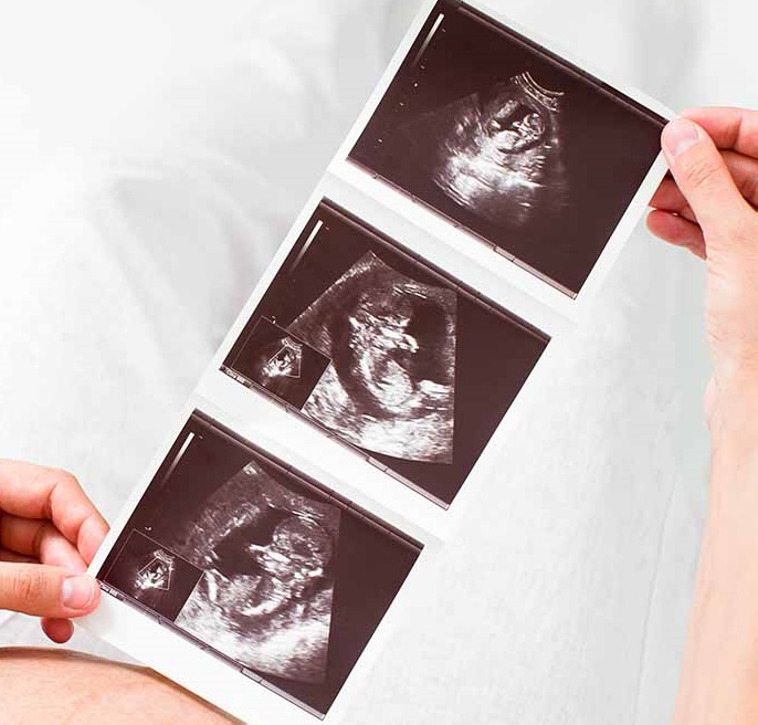 Anemia Gestacional: relação com o baixo peso do bebê ao nascer e a prematuridade